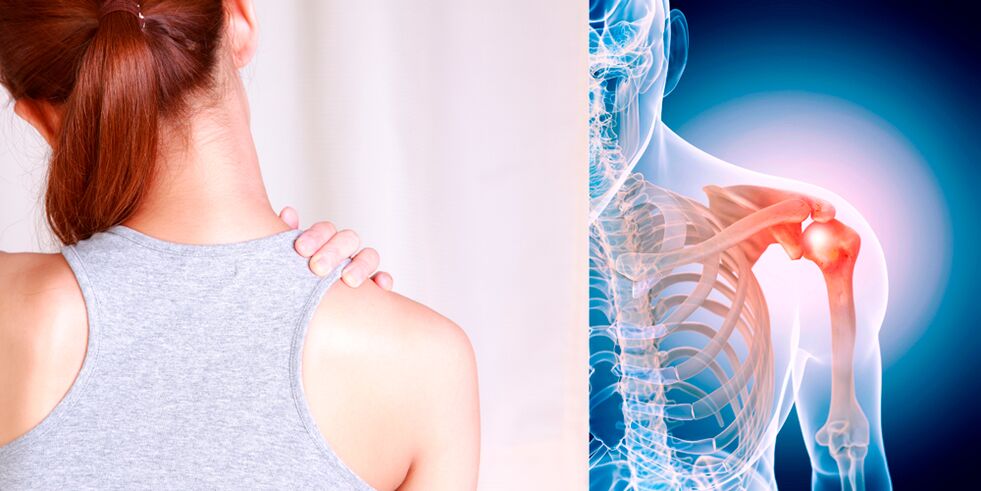 The development of osteoarthritis of the shoulder gradually leads to constant pain. 