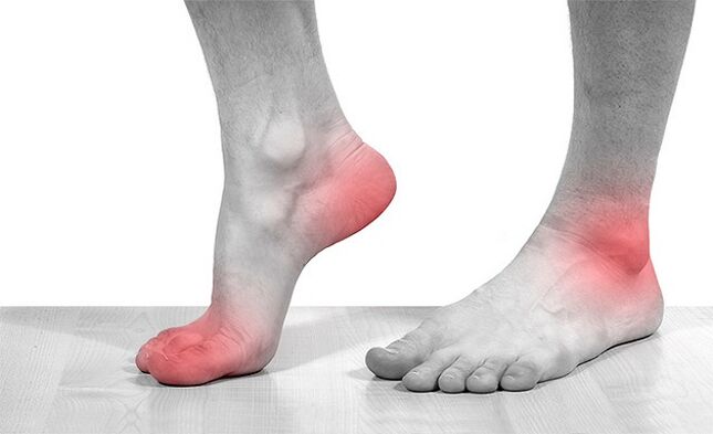 ankle joint pain with osteoarthritis