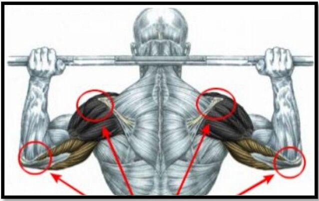 The load on the muscles of the shoulder and elbow is one of the causes of osteoarthritis of the shoulder joint. 