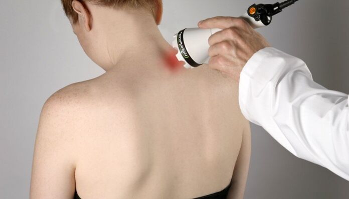 Laser therapy for cervical osteochondrosis.