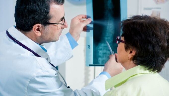 X-ray as a method for diagnosing cervical osteochondrosis.