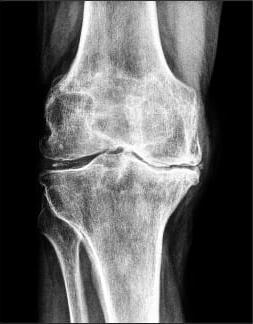 x-ray of